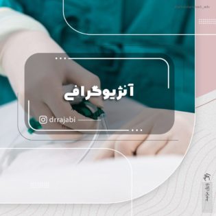 آنژیو گرافی