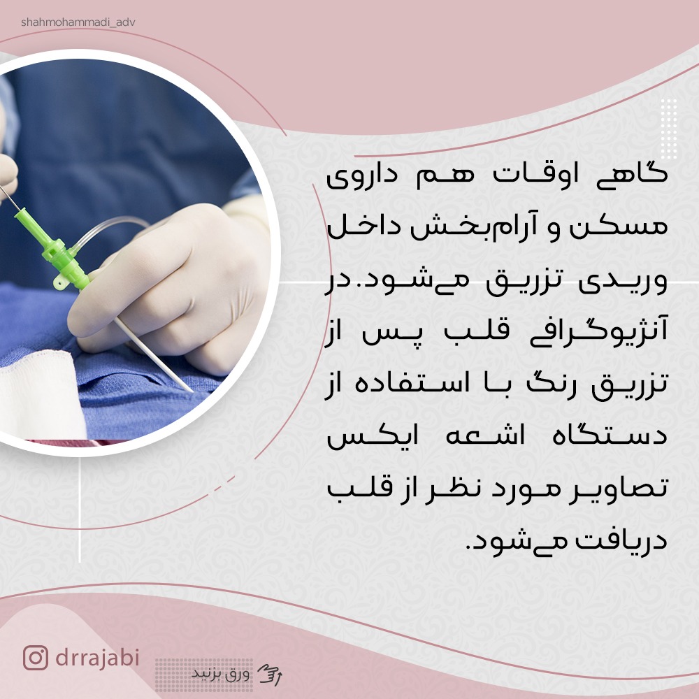 آنژیو گرافی