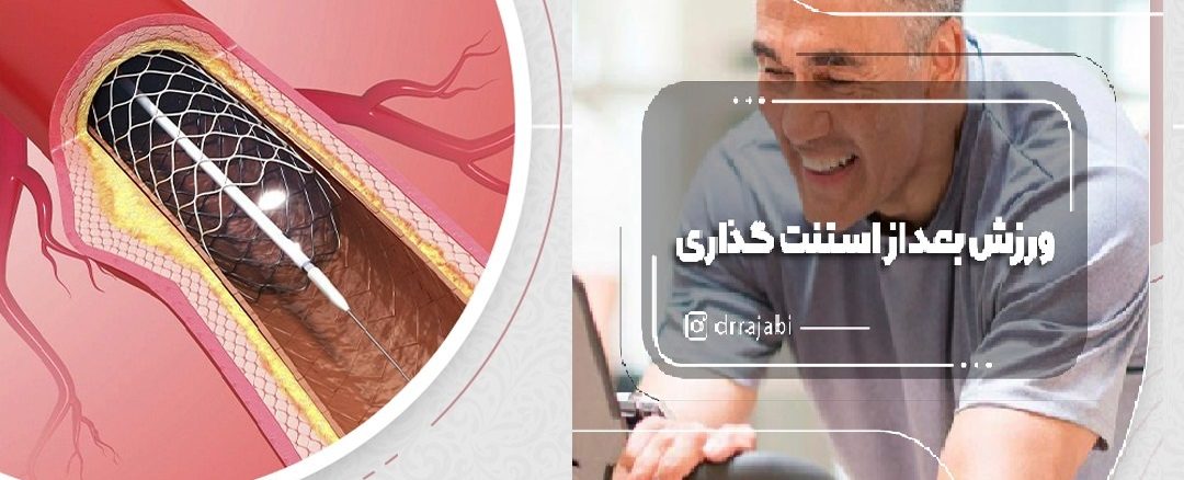 استنت بعد از ورزش